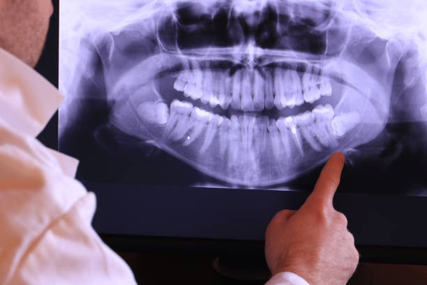 Best Urgent Care for Lost Fillings or Crowns in Kinder, LA