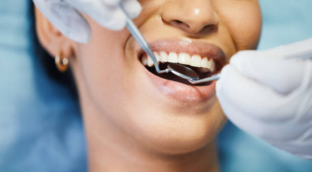 Best Cosmetic Emergency Dentistry in Kinder, LA